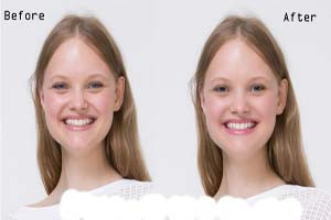 Photo Retouching Service